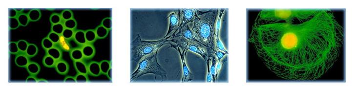 倒置荧光显微镜MHIF1000成像实拍图.jpg 倒置荧光显微镜MHIF1000成像实拍图.jpg